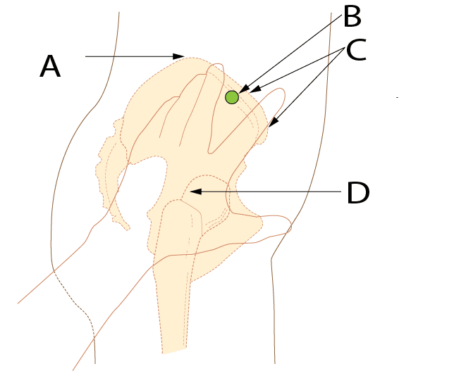 Question illustration for Q1
